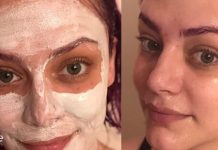 This mask is incredible for blackheads on the face! It works wonders!