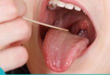 How can you cure tonsil inflammation in 24 hours?