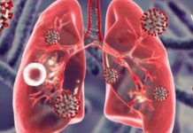 How to defeat pulmonary tuberculosis?